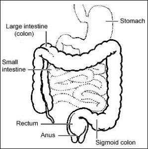 Ulcerative Colitis Treatment Los Angeles | GI Doctor LA