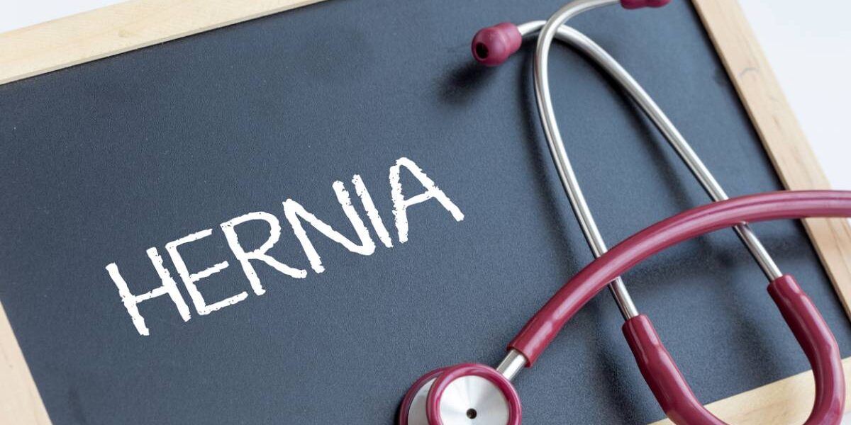 How To Prevent A Hernia Siamak Tabib Md Blog